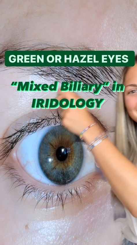 amandanovawellness on Instagram: 👁In iridology we refer to an eye with both lymphatic and Hematogenic colors as “mixed biliary.” Many people who have mixed biliary irises… Gall Bladder, Stomach Issues, Right Light, Naturopathy, The Liver, Holistic Nutrition, Small Meals, Digestive Enzymes, Hazel Eyes