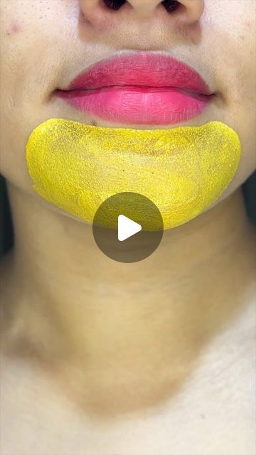 Priya Creations on Instagram: "chin blackheads and Whiteheads removing free at home remedy #reelkarofeelkaro❤️❤️❤️❤️ #reelkarofeelkaro #diy #skincare #skincareroutine #skincaretips #homeremedies #homeredy #blackandwhite #whiteheads #reels #reel #viral #viralreels" Whiteheads Removal Remedies, Black Head Remover Diy, Chin Whiteheads, Chin Blackheads, Remove Whiteheads, Whiteheads Removal, Blackheads And Whiteheads, Clean Blackheads, Under Eye Wrinkles