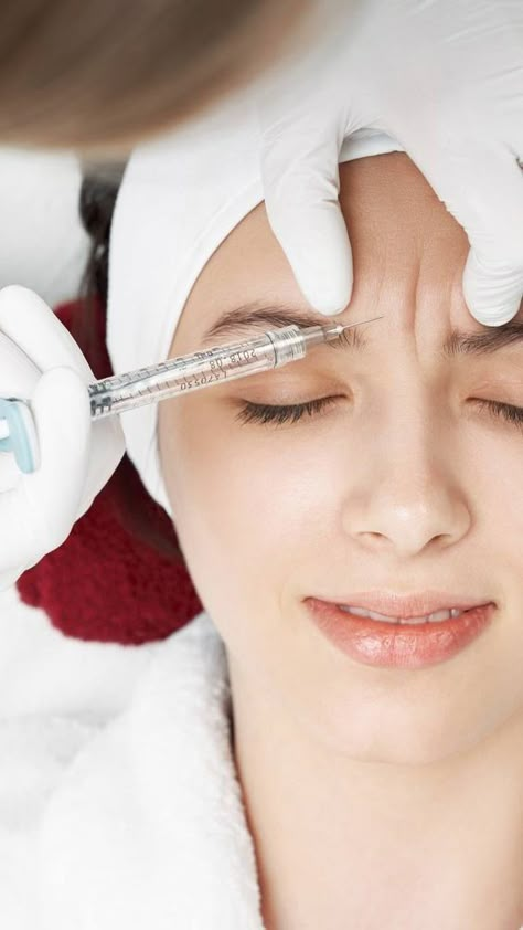 Because the body takes some time to adjust to the injections, Botox outcomes are not seen right away. It works as a neuromodulator to relax and soften the muscular movements that generate wrinkles.  Improvements usually become visible after 3 to 5 days, and full results usually take 10 days. After just one surgery, fine wrinkles will start to disappear. https://medicaestetica.nl/botox-correct/ Aesthetics Business, Spa Quotes, Instagram Grid Design, Aesthetic Center, Lifting Facial, Skin Wrinkles, Facial Fillers, Makeover Tips, Fine Wrinkles