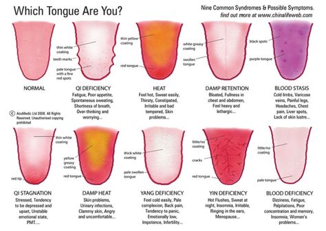 Autogenic Training, Tongue Health, Running Tips, Traditional Chinese Medicine, Reflexology, Health Info, Chinese Medicine, Acupressure, Natural Medicine