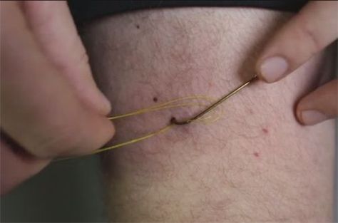 Video Pro Tip: How to Remove a Fish Hook from Your Skin - Orvis News: Fly Fishing Tips, Fly Fisherman, Pro Tip, Fly Rods, Gone Fishing, Fish Camp, Saltwater Fishing, Kayak Fishing, Sea Fish