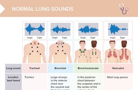 Lung Sounds Cheat Sheet, Lung Sounds Nursing, Nursing Prerequisites, Nursing Career Paths, Nursing Cheat Sheet, Lung Anatomy, Lung Sounds, Medical Study, Breath Sounds