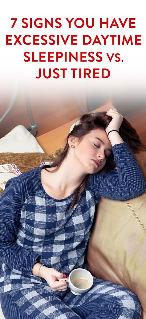 7 Signs You Have Excessive Daytime Sleepiness Vs. Just Tired Over Tired, Tired And Sleepy, Daytime Sleepiness, Sleeping Too Much, Just Tired, Sleep Remedies, Medical Examination, Sleep Health, When You Sleep