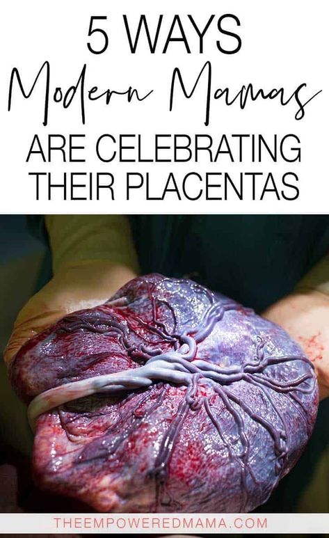 Placenta Recipes, Placenta Art, Anterior Placenta, Placenta Encapsulation, Birth Education, Pregnancy Help, All About Pregnancy, Natural Pregnancy, Birth Labor