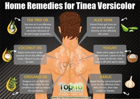 Home remedies for Tinea Versicolor Tinea Versicolor, Toenail Fungus Remedies, Top 10 Home Remedies, Healthy Fruit, Holistic Remedies, Toenail Fungus, Fungal Infection, Natural Therapy, Skin Remedies