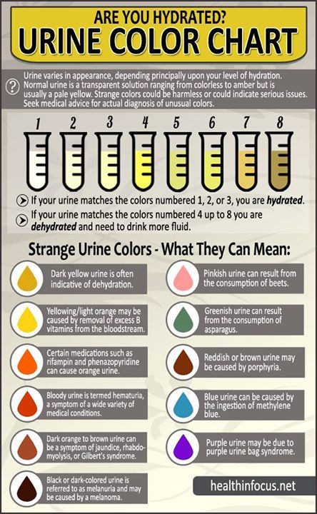 Urine Color Chart, Urine Color, Clogged Arteries, Medical Laboratory Science, Nursing School Survival, Nursing School Studying, Medical Facts, Health Professional, Nursing School Tips