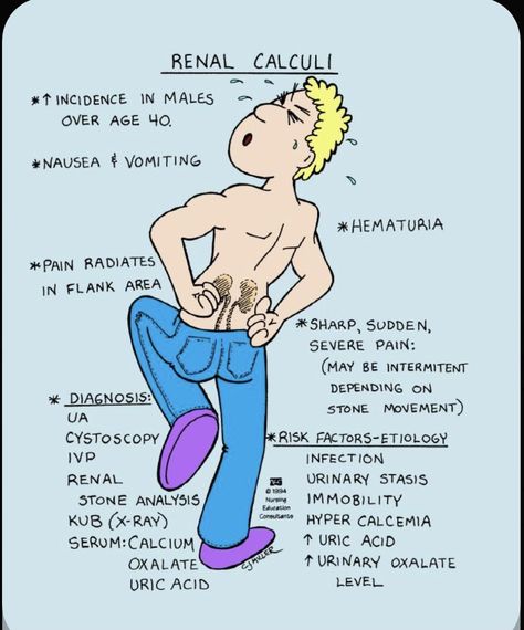 Renal Calculi, Nursing School Essential, Nursing Study Guide, Nurse Study Notes, Nursing Mnemonics, Nursing Student Tips, Surgical Nursing, Medical Surgical Nursing, Pharmacology Nursing