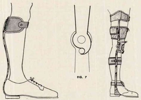 Figure 6-Ankle brace with single posterior bar. Figure 7-Reverse 90° stop. Figure 8_Knee brace with calfband and two thigh bands. Knee Brace Aesthetic, Mike Costume, Knee Anatomy, Hip Brace, Thigh Bands, Ankle Brace, Leg Braces, Ankle Braces, Retro Disney