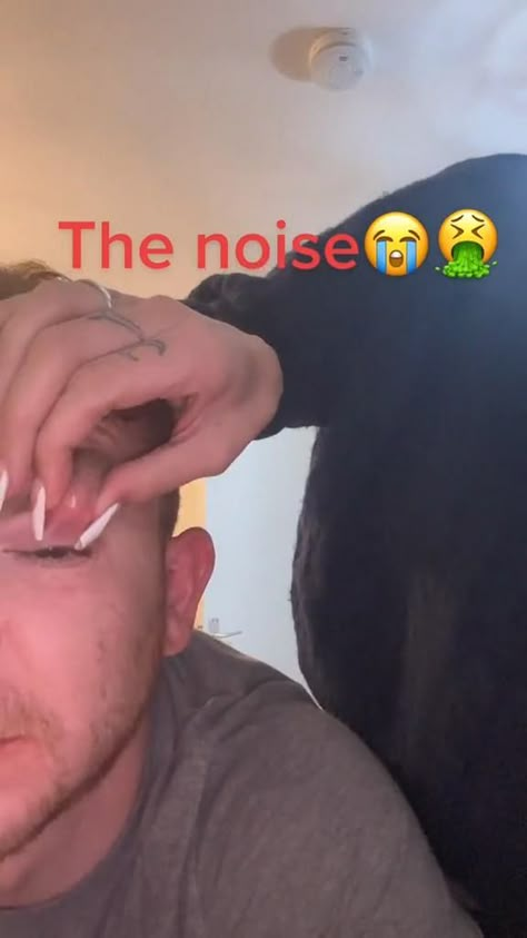 Pimple on boyfriends face listen to to that pop  . . . . #pimplepop #popping pimples #SkincareRoutine #GlowingSkin #BeautySecrets #HealthySkin #SkincareTips #RadiantComplexion #BeautyRoutine #PinterestVideo #SkinCareExperts #satisfying #pimple #pop Removing Blackheads From Nose Videos, Best Acne Scar Removal, Head Pimples, Black Head Removal, Ear Pimple, Nose Pimples, Squeezing Blackheads, Pore Extraction, Pimple Popper Tool