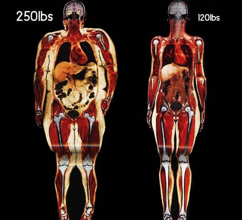 This really puts things into perspective. Be Healthy! Psa Poster, Daglig Motivation, Exercise Benefits, Fitness Memes, 120 Pounds, Ideal Protein, Body Scanning, The Human Body, I Work Out