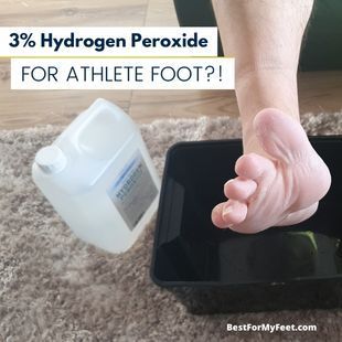 testing if 3% hydrogen peroxide has enough strength for getting rid of Athlete's foot. Peroxide Uses, Athletes Foot, Foot Bath, What To Use, Hydrogen Peroxide, Best Skin, On My Own, Good Skin, Home Remedies