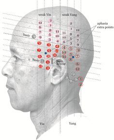 Yamamoto Scalp Acupuncture Body Reflexology, Acupuncture Points Chart, Traditional Chinese Medicine Acupuncture, Acupuncture Benefits, Mental Health Facts, Reflexology Massage, Shiatsu Massage, Acupuncture Points, Acupressure Points