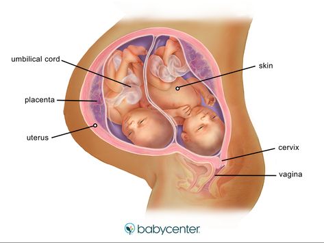 Twins In The Womb, Last Week Of Pregnancy, Prenatal Development, 24 Weeks Pregnant, 28 Weeks Pregnant, Pregnant With Twins, 5 Months Pregnant, 36 Weeks, Pregnancy Hormones