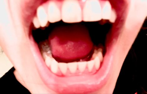 teeth inside a mouth wide open #grunge #teeth #aesthetic #emo #alt #scary #creepy Mouth Wide Open, Teeth Aesthetic, Aesthetic Emo, Scary Creepy, Quick Saves