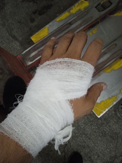 Fake Wounds Photo Hand, Bandage On Hand Photo, Hand Kata Pic Real, Burn Hand Pics, Boyfriend Surprises Girlfriend, Boyfriend Surprises, Bandage Hand, Ft Calls Pictures, Hospital Admit