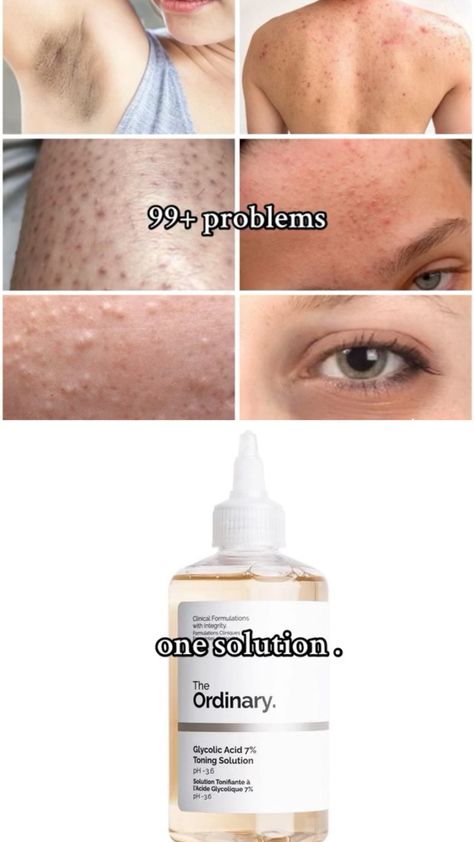 The Ordinary Back Acne, Best Skincare Products For Dark Spots, Best Products From The Ordinary, The Ordinary Toner Before And After, Glycolic Acid On Face, Skin Care Textured Skin, Ordinary For Dark Spots, Best Acids For Skin, Products For Back Acne