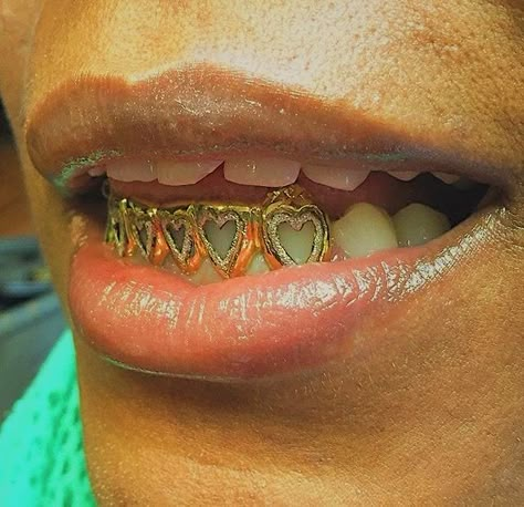 Open Face Grillz, Mouth Grills, Girl Grillz, Grillz Teeth, Gold Grill, Diamond Teeth, Gold Grillz, Grills Teeth, Tooth Gem