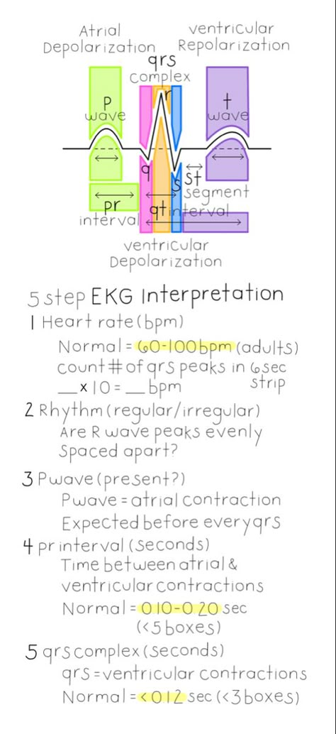 Nursing, nurse, nursing notes, rn, registerednurse, cardiovascular system, cardio, ekg, ekg interpretation, cheat sheet, study notes Ekg Nursing Cheat Sheets, Ekg Notes Cheat Sheets, 3 Lead Ekg Placement, Lethal Rhythms Ekg, Ekg Basics Nursing, Ekg Notes Nursing Students, Ekg For Dummies, Ekg Reading Cheat Sheets, Ekg Cheat Sheet