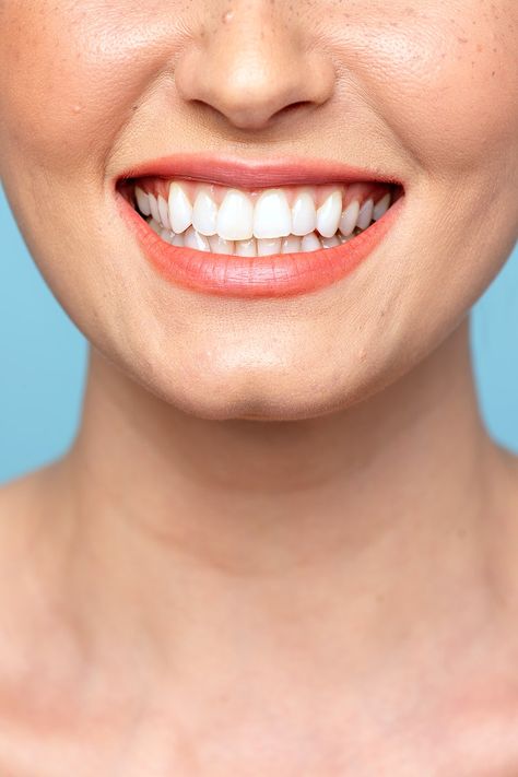 Happy woman with a bright smile | premium image by rawpixel.com / Teddy Dental Campaign, Glossy Red Lipstick, Smiling Person, Teeth Images, Funny Facial Expressions, About Smile, Tooth Icon, Dental Floss Picks, Floss Picks