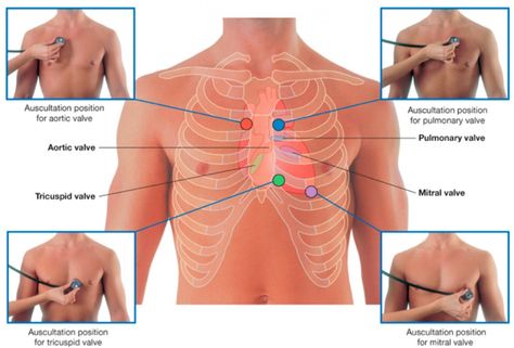 Cardiology II: Heart Sounds, Cardiac Output And Arterial Blood Pressure Cardiac Assessment, Tricuspid Valve, Nursing Assessment, Heart Sounds, Heart Valves, Nursing Mnemonics, Cardiac Nursing, Nursing School Tips, Nursing Tips