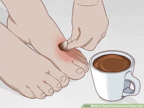 Stop Poison Ivy Itch, Poison Oak Remedy, Poison Sumac Rash, Poison Oak Remedies, Poison Ivy Home Remedies, Poison Oak Rash, Poison Ivy Plants, Poison Ivy Remedies, Poison Ivy Rash