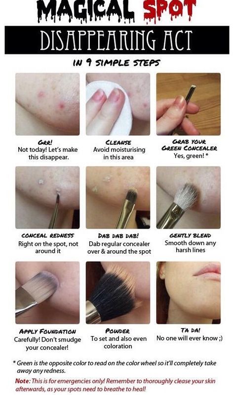 How To Cover Up Your Acne And Acne Spots Perfectly!!💜👍😘💜👍😘 | Green concealer, How to hide pimples, Makeup tips #How_To_Hide_Pimples #Green_Concealer #Make_Up_Diy #1920s_Makeup How To Hide Pimples, Covering Acne With Makeup, 1920’s Makeup, Green Concealer, Make Up Diy, Bad Acne, Natural Nail Care, Best Makeup Tips, Skin Nails