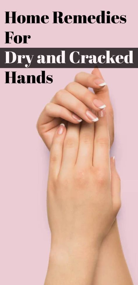 Home Remedies For Severely Dry and Cracked Hands| Dry Hands Remedy Homemade Soft Hands Remedy, How To Get Rid Of Dry Hands, Dry Cracked Hands Remedy, Cracked Hands Remedy, Chapped Hands Remedy, Hand Remedies, Dry Hands Remedy, Hand Scrub Diy, Dry Hand Skin