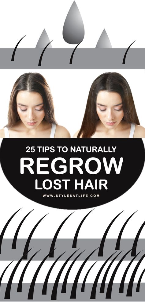 Best Hair Regrowth Products For Women, Hair Regrowth Tips, Regrow Lost Hair, Hair Formulas, Hair Regrowth Remedies, Hair Regrowth Women, Regrow Hair Naturally, Stop Hair Breakage, Hair Repair Treatments