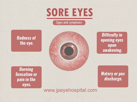 Sore Eyes  Signs and symptoms  #Eyes #SoreEyes #RednessofEye #DifficultyinOpeningEyes #Visit :http://www.jpeyehospital.com #WhatsApp :- +91- 9914874442, #CallUsNow :- +91- 9216066613 #EyeCareHospital #ChildEyeCare #JpeyeCare #Chandigarh #Mohali #India #jpeyehospital #Cataract #Glaucoma #Lasik Doctor Checking Patient, Diy Clipboard, Lasik Surgery, Bond Paper Design, Low Estrogen, Sore Eyes, Eye Surgery, Bond Paper, Toenail Fungus