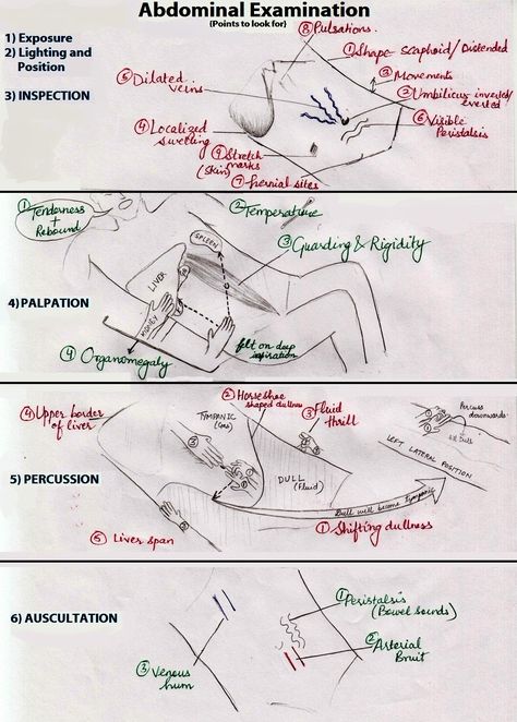 Image result Abdominal Examination, Rovsing's Sign, Quadrants Of The Abdomen, Gi System, Nurse Notes, Mcat Study, Physical Examination, Medical Study, Medical Notes