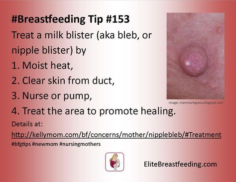 Bf Tips, Milk Blister, Increase Breastmilk Supply, Power Pumping, Increase Breastmilk, Postpartum Health, Baby Luna, Moist Heat, Breastmilk Supply