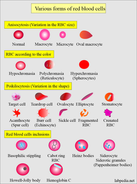 Red Blood Cells Sample for CBC Takes blood in the EDTA. Direct blood smears for the appreciation of the RBC morphology. Indications for Complete blood count (CBC) To diagnose the various types of anemia. Any other abnormality of white blood cells and platelets. Pathophysiology of the red blood cells: Red blood cell metabolism is important for its survival and function. Red blood cell metabolism is dependent upon: Red blood cell membrane: The RBC membrane co... Cell Membrane Structure, Medical Laboratory Science Student, Medical Lab Technician, Medical Laboratory Technician, Abnormal Cells, Medical Laboratory Science, Biology Lessons, Medical School Inspiration, Biology Notes