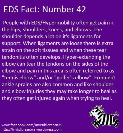 EDS Stretches For Men, Ehlers Danlos Syndrome Symptoms, Golf Stretches, Elhers Danlos Syndrome, Ehlers Danlos Syndrome Hypermobility, Ehlers Danlos Syndrome Awareness, Dysautonomia Pots, Golfers Elbow, Mast Cell Activation Syndrome