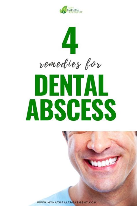 Here you have the most amazing 4 natural remedies for dental abscess with simple herbs and effective mixtures that actually work. Dental Abscess Remedies, Essential Oils For Abscess Tooth, Gum Abscess Remedies, Absessed Tooth Remedies, Tooth Infection Remedy, Absessed Tooth Remedies Diy Home, Abcessed Tooth Remedy Swelling, Tooth Abcess Remedy Home, Abscess Tooth Remedies