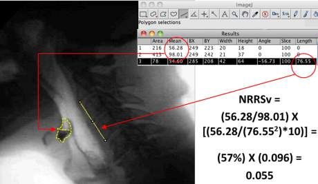 Acute Care Slp, Slp Data Collection Sheets, Motor Speech Disorders, Osgood Schlatter Disease, Barium Swallow, Speech Therapy Data Collection Sheets, Gastrointestinal System, University Of Toronto, Speech Pathology