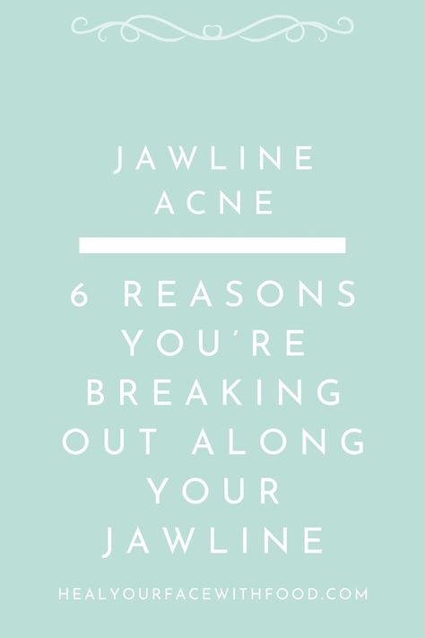 Do you struggle with jawline acne and are you super confused as to WHY often? Today I’m sharing 6 reasons you’re breaking out along your jawline (and the rest of your face too!) + action steps you can take to begin to treat jawline acne naturally today! Jawline Acne Causes, Clear Acne Naturally, Jawline Acne, Clear Skin Diet, Acne Causes, Clear Skin Tips, Personality Quiz, Acne, Skin