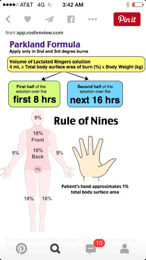 Burns Nursing, Nbcot Exam, Medicine School, Nurse Notes, Paramedic School, Medical Study, Nursing Fun, Nclex Pn, Medical Mnemonics