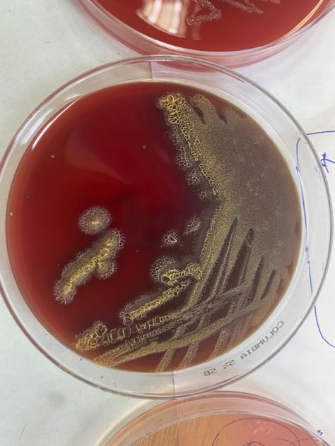 Pseudomonas aeruginosa on 5% Sheep blood agar #pseudomonas #microbiology #clinical #biology #science #genetics #bacteria #pathologic Science Genetics, Medical Laboratory Science Student, Pseudomonas Aeruginosa, Biology Science, Medical Laboratory Science, Laboratory Science, Medical Laboratory, Science Student, Microbiology