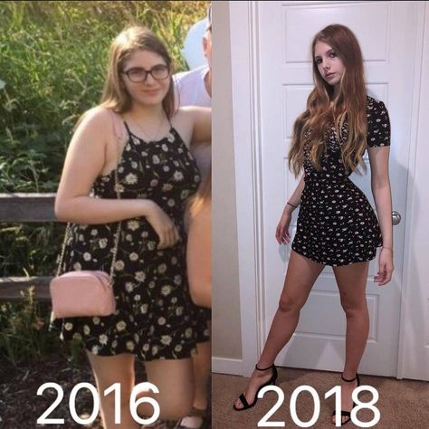 Outstanding Transformations on Instagram: “205lbs vs 135, 5’ 10”, 2016 vs 2018. I’ve gotten contacts straighten my teeth and lost 70 pounds. I’ve been asked about the weight part a…” Diet Pills That Work, Tanya Burr, Lose 25 Pounds, Fitness Video, Keto Foods, Help Losing Weight, Fitness Challenge, Motivation Fitness, Diet Pills