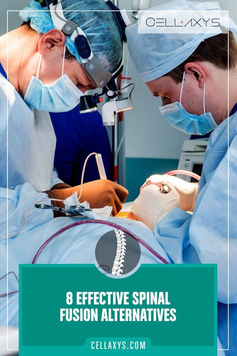 8 Effective Spinal Fusion Alternatives Spinal Fusion Surgery, Mayo Clinic Diet, Lumbar Pain, Spinal Fusion, Spinal Surgery, Neck Surgery, Spine Surgery, Mayo Clinic, Back Exercises