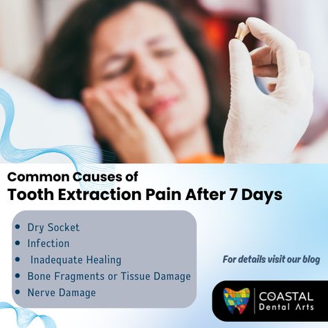 Tooth Extraction Discomfort After 7 Days Wisdom Teeth Pain Relief, Wisdom Teeth Pain, Tooth Pain Relief, Dry Socket, Tooth Removal, Gap Teeth, Tooth Pain, Tooth Extraction, Nerve Damage