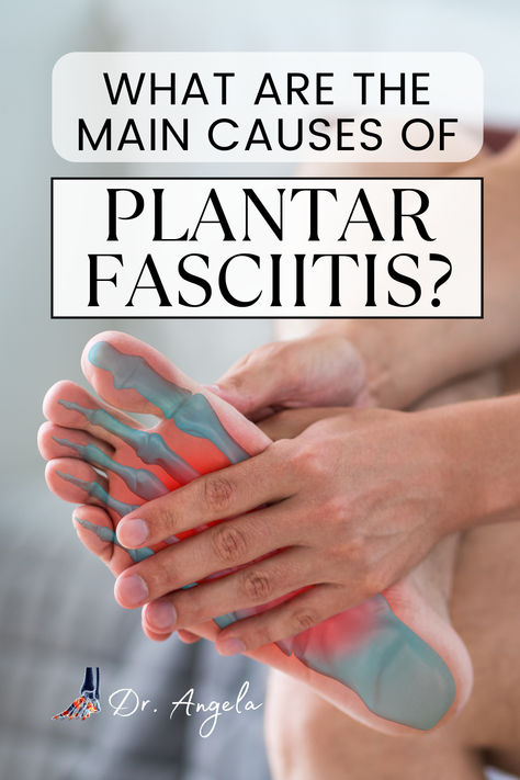 Remedies For Planters Fasciitis, Home Remedy For Plantar Facitis, Planter Fasciitis Physical Therapy, Plantar Fascia Tens Unit, Plantar Fascia Healing, Stretches For Plantar Fascia, Plantar Facitis Workout, Stretches For Plantar Fascia Relief, Plantar Fascia Kt Taping