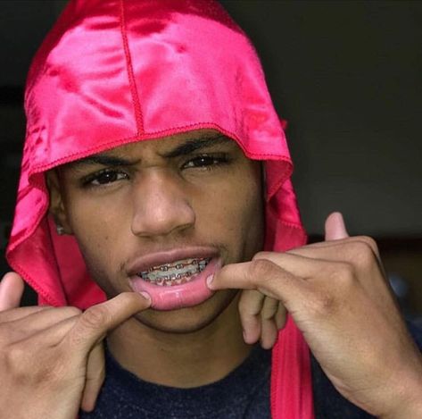 🤩 braces #braceface #braces #lightskin #durags Guys With Braces, Kawaii Logo, Cute Braces, Brace Face, Braces Colors, Light Skin Men, Straight Teeth, Teeth Braces