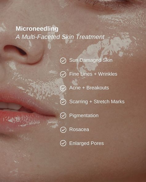 Microneedling is one of our top-selling facial treatments that uses tiny needles to create micro-channels in the skin, stimulating collagen production and improving the texture, tone, and overall appearance of your skin.   Ready to try microneedling? For a limited time we're offering the Repair and Rejuvenate Trio, the ultimate solution for a healthy, smooth complexion!  Available now for the amazing price of only $699 (Value of $853)!   ➡️ Use Code: REPAIR to purchase online Medical Facial Treatments, Skin Consultation Aesthetic, What Is Microneedling, How Much Product To Use On Face, Microdermabrasion Aesthetic, Skin Clinic Aesthetic, Microneedling Video, Microneedling Before And After, Microneedling Aesthetic