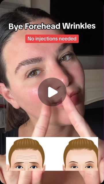 Sarah Fraggis on Instagram: "Smooth away forehead wrinkles naturally with GuaSha and facial cupping!   Gua sha is often referred to as "Eastern Botox"  Try this routine with our nourishing, specify formulated oils and track you results  .Head to filterlessera.com for all the tools and products you need to achieve radiant skin  Xoxo- Sarah #GuaSha #FacialCupping #NaturalSkincare #YouthfulGlow #FacialRejuvenation #HolisticBeauty #SkinCareTools #BeautyRituals" Forehead Wrinkles Gua Sha, Facial Cupping, Forehead Wrinkles, Facial Rejuvenation, Face Exercises, Holistic Beauty, Face Yoga, Skincare Tools, Gua Sha