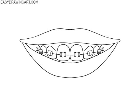 braces drawing lesson Braces Drawing Anime, Teeth With Braces Drawing, Smile With Braces Drawing, Braces Drawing Reference, How To Draw Braces, Drawing Braces, Braces Drawing, Sketch Mouth, Work Doodles