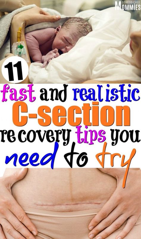 Healing From C Section, C Section Recovery, Cesarean Section, Pumping Moms, Baby Sleep Problems, Postpartum Care, C Section, Postpartum Recovery, After Baby