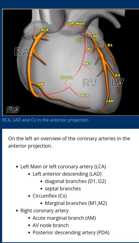 Cath Lab Guider - Coronary anatomy Cath Lab Nursing, Cath Lab Nurse, Cardiac Sonography, Diagnostic Medical Sonography, Nursing School Essential, Basic Anatomy And Physiology, Nurse Study Notes, Nursing Mnemonics, Nursing Student Tips