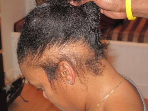 Black women and hair loss- traction Alopecia Grow Thicker Hair, Natural Hair Rules, Traction Alopecia, Regrow Hair, Black Hair Care, Natural Hair Tips, Hair Breakage, Long Hair Girl, Hair Maintenance