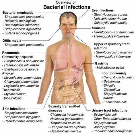 Nursing School Studying, Nursing School Notes, Nursing Tips, Bacterial Infection, Nursing Study, Nursing Education, Nursing Notes, Medical Knowledge, Medical Education